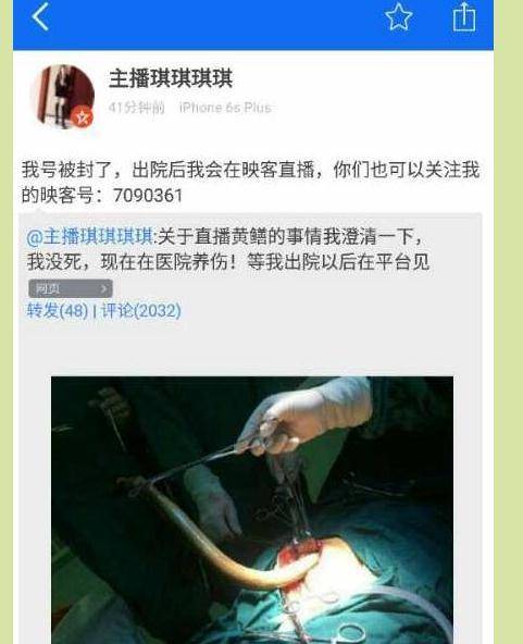 成年女子毛片的相关介绍