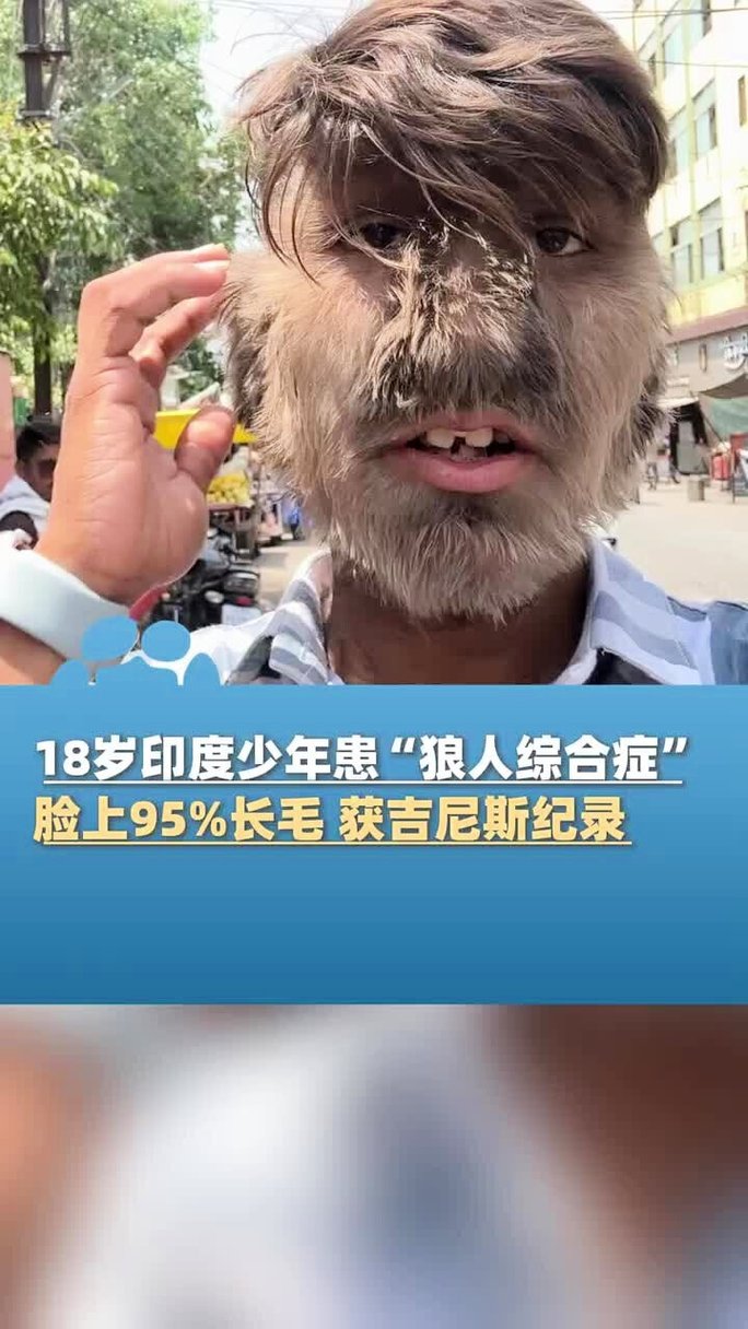 激情综合色综合久久丁香的相关介绍