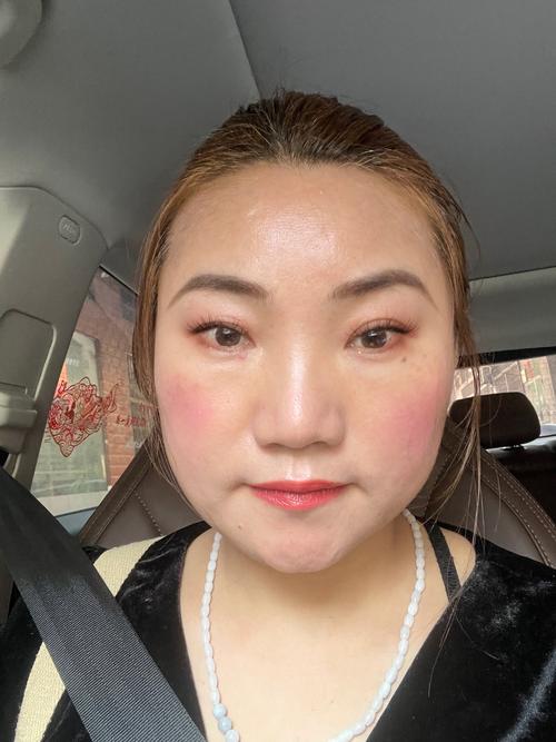 女性内裤总有黄色分泌物的相关介绍